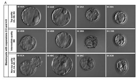 Embryo Grading - Quality Chart And IVF Success Rates