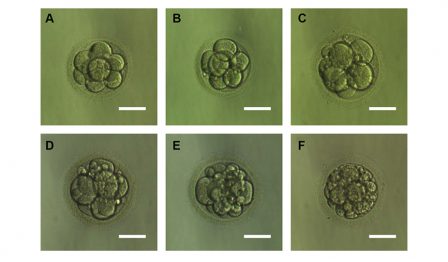 Embryo Grading - Quality Chart And IVF Success Rates